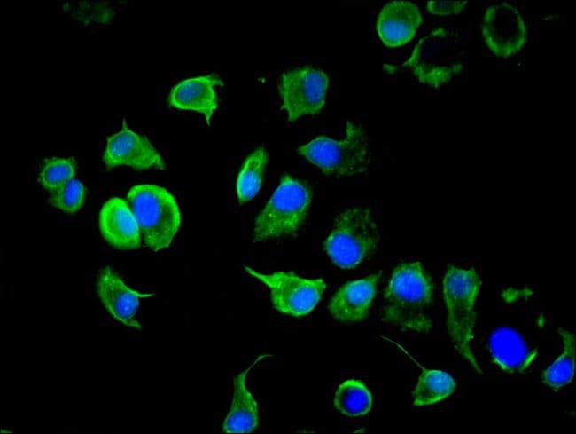 100UG CYTOKERATIN 10 ANTIBODY 100 ug