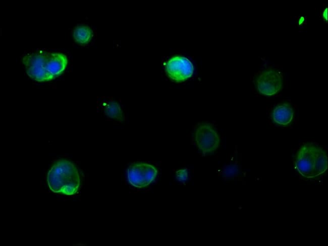 100UG CYTOKERATIN 16 ANTIBODY 100 ug