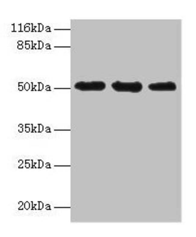 100UG KRT38 ANTIBODY 100 ug