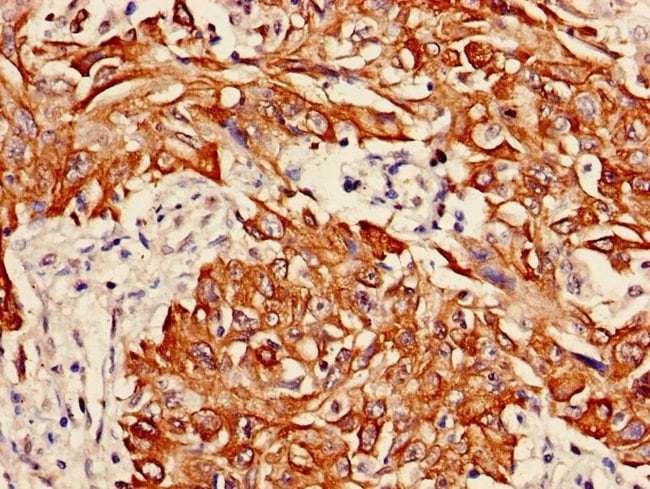 100UG CYTOKERATIN 6A ANTIBODY 100 ug
