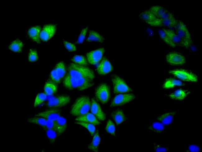 100UG CYTOKERATIN 6A ANTIBODY 100 ug