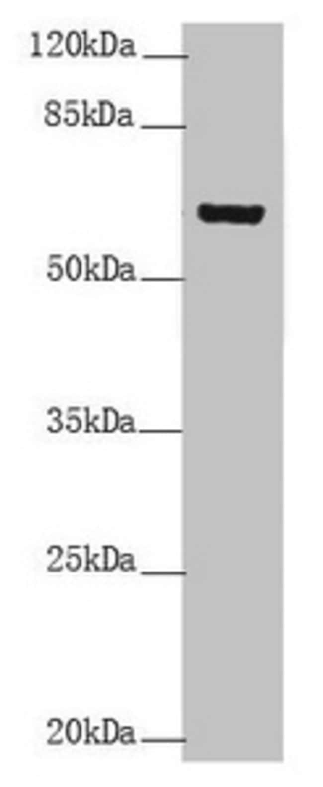 100UL CYTOKERATIN 6B ANTIBODY 100 ul