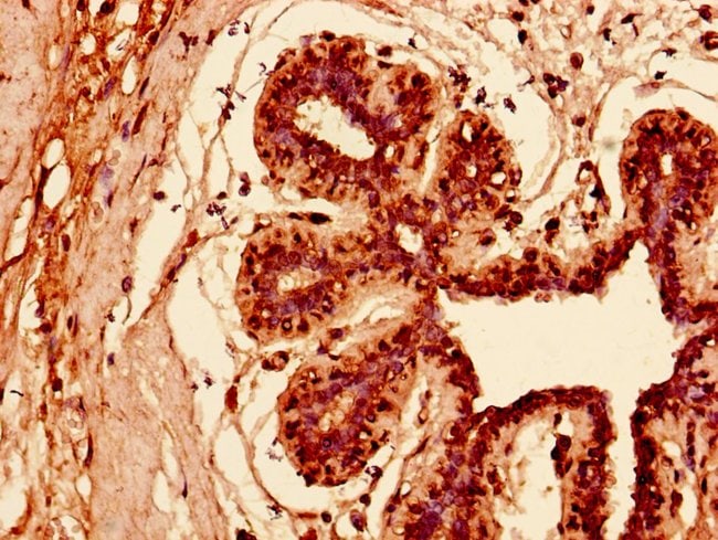 100UG KRT81 ANTIBODY 100 ug