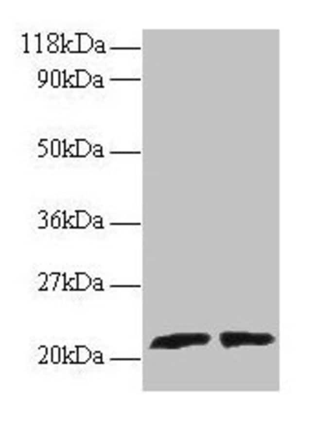 100UG ARL2 ANTIBODY 100 ug
