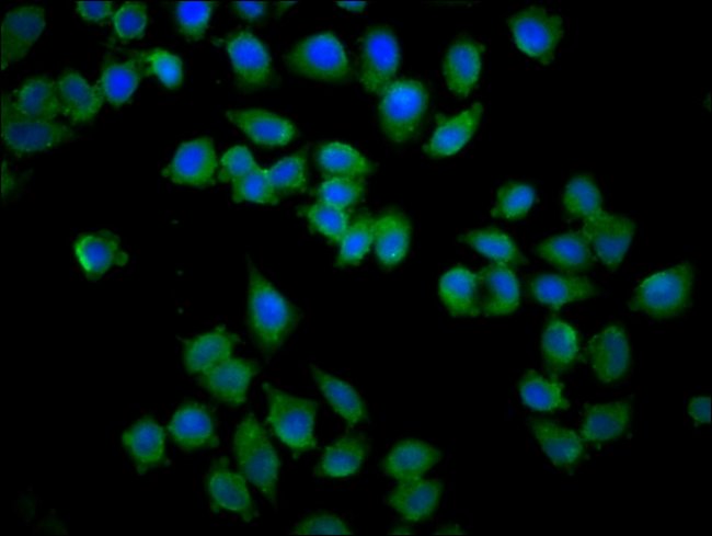 100UG KY ANTIBODY 100 ug