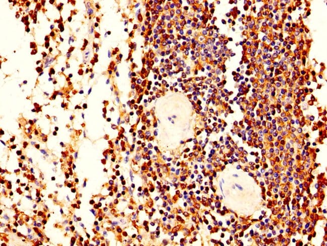 100UG L-PLASTIN ANTIBODY 100 ug