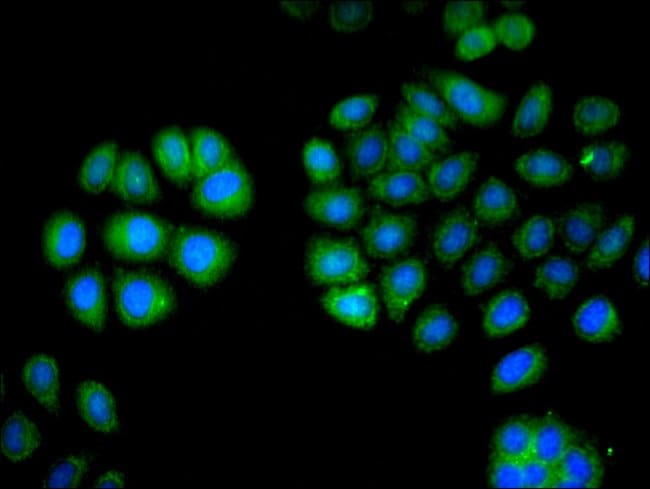 100UG L-PLASTIN ANTIBODY 100 ug