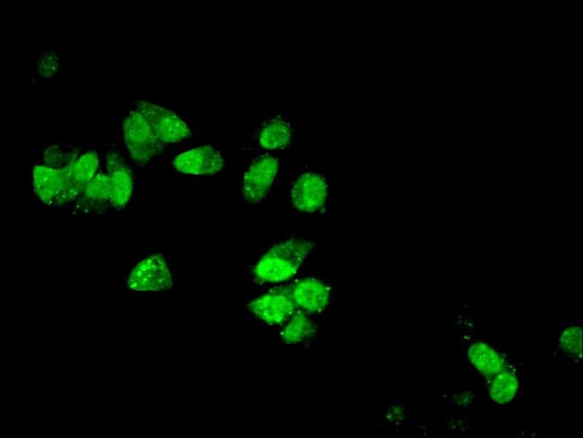 100UG DYNLL1 ANTIBODY 100 ug