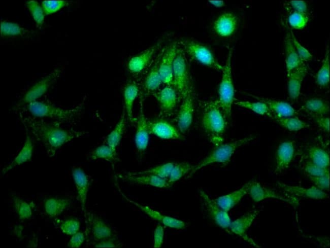 100UG LETM1 ANTIBODY 100 ug