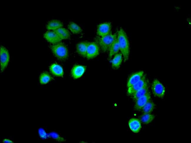 100UG LHR ANTIBODY 100 ug