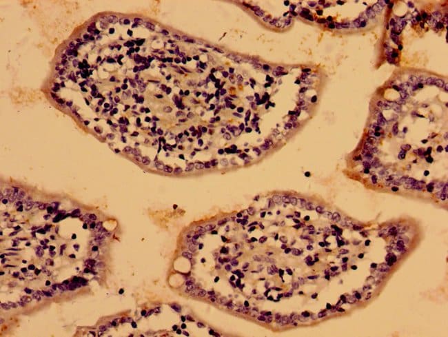 100UG LIPA ANTIBODY 100 ug