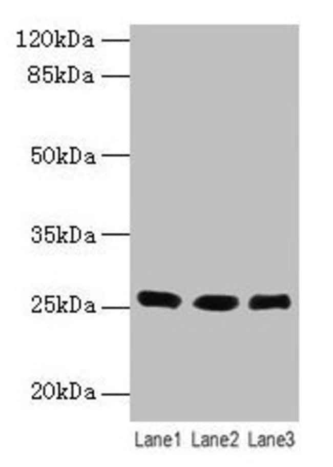 100UG LIN7A ANTIBODY 100 ug