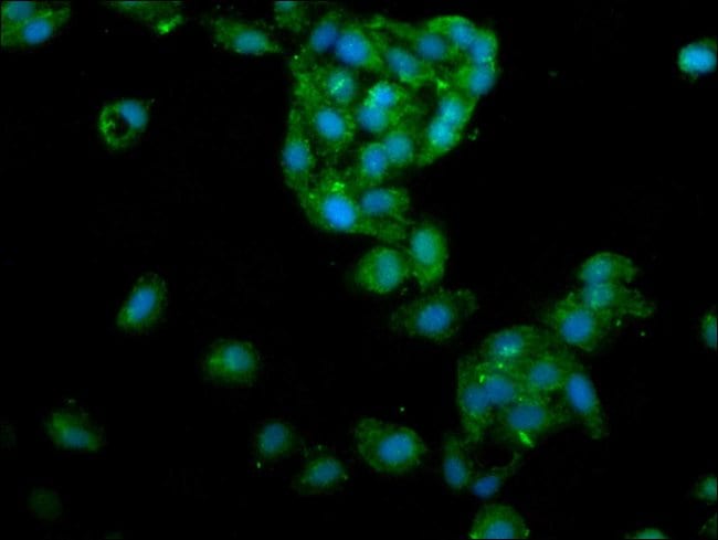100UG LIPA ANTIBODY 100 ug
