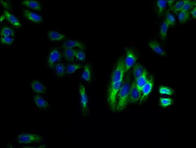100UG LPAR4 ANTIBODY 100 ug
