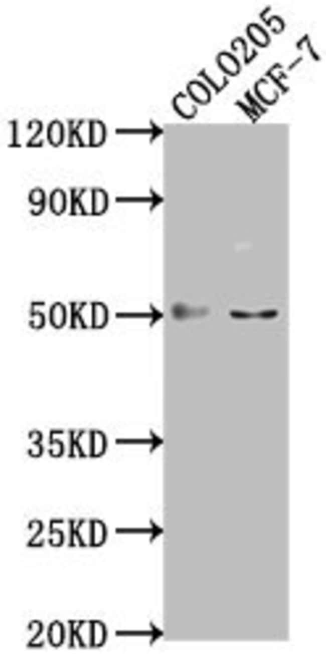 100UL LRAT ANTIBODY 100 ul
