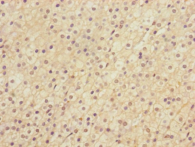 100UL LRP4 ANTIBODY 100 ul