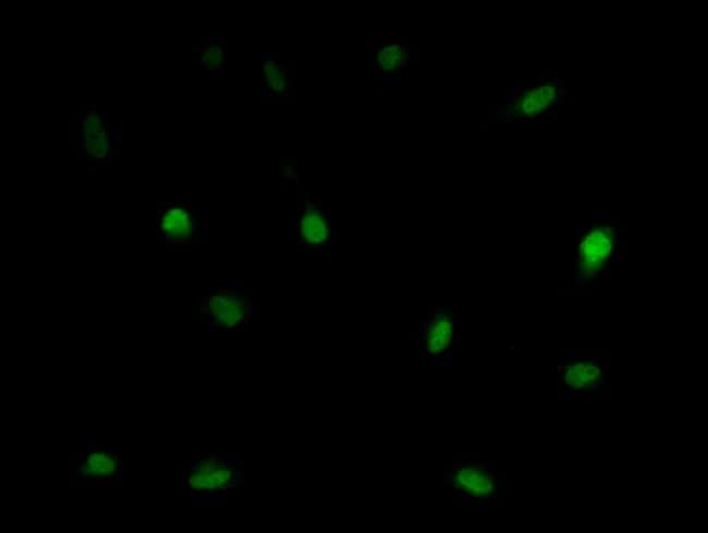 100UL LSM11 ANTIBODY 100 ul