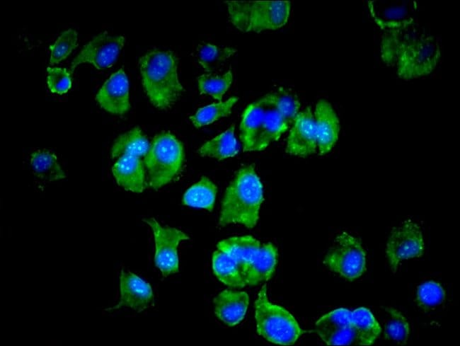 100UG LSM4 ANTIBODY 100 ug
