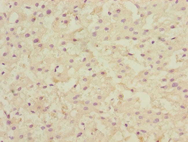 100UL LSS ANTIBODY 100 ul