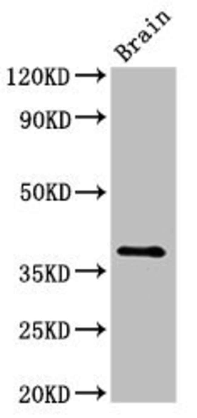 100UG LUM ANTIBODY 100 ug