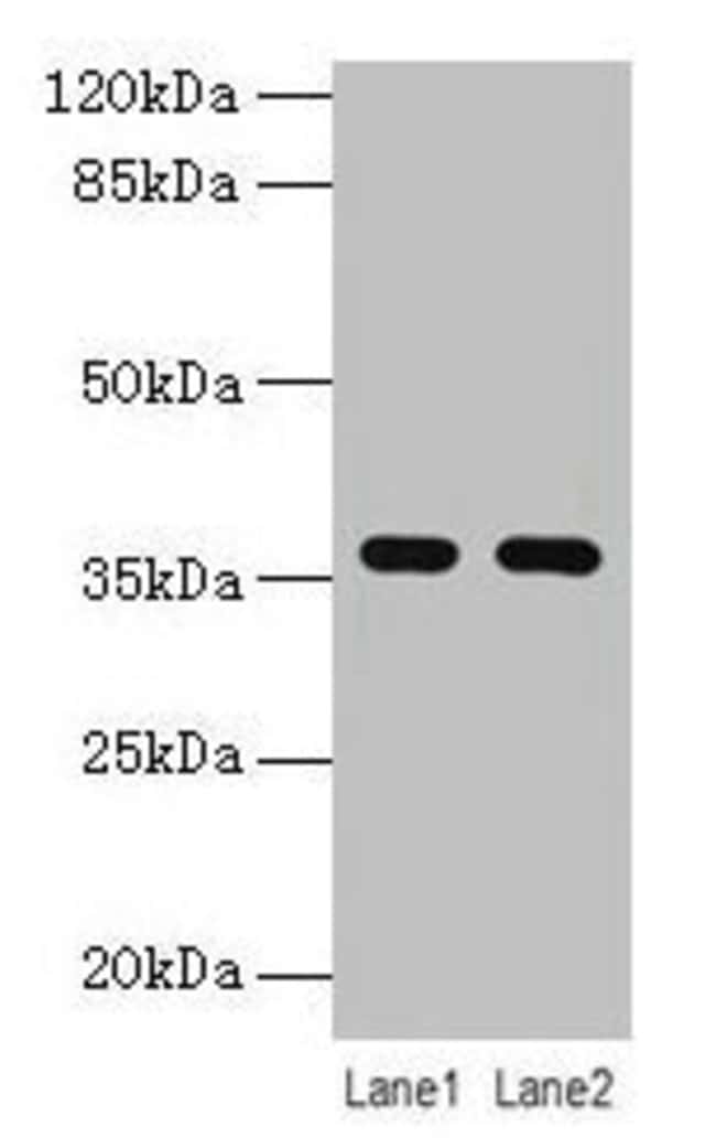 100UG LYPD3 ANTIBODY 100 ug