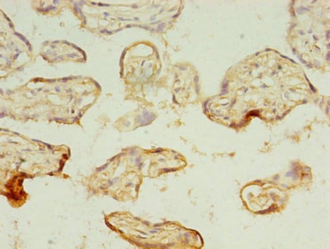 100UG MAGEA10 ANTIBODY 100 ug