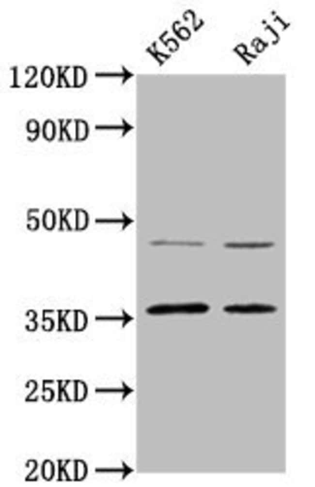 100UG MAGEA2 ANTIBODY 100 ug