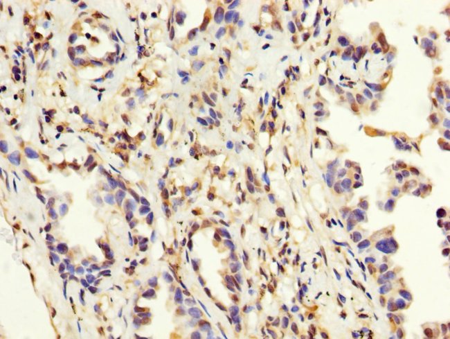 100UG MAGEA3 ANTIBODY 100 ug
