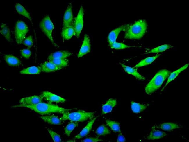 100UG PSMA7 ANTIBODY 100 ug
