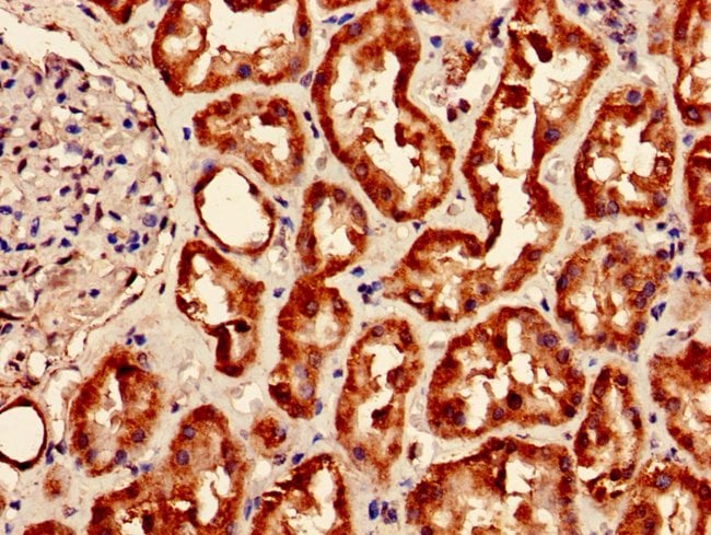 100UG MAOA ANTIBODY 100 ug