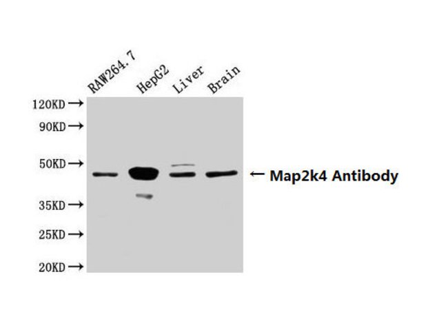 100UG SEK1 ANTIBODY 100 ug