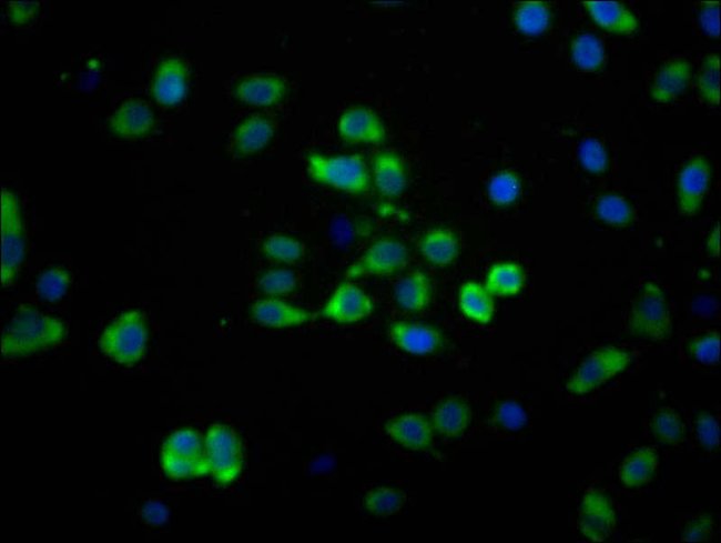 100UG MAS1 ANTIBODY 100 ug