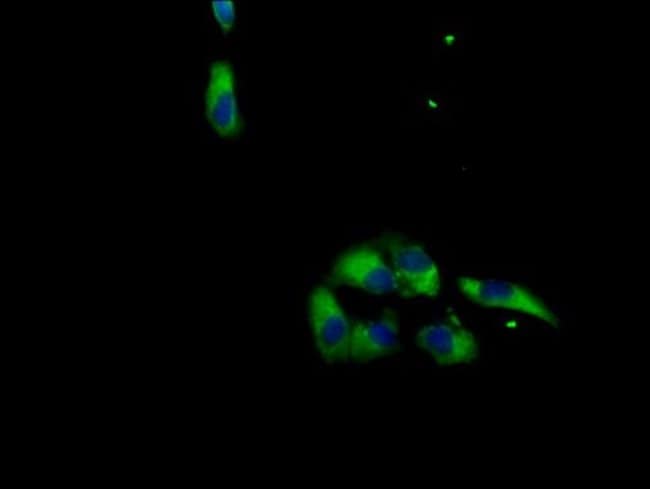 100UG MAS1L ANTIBODY 100 ug