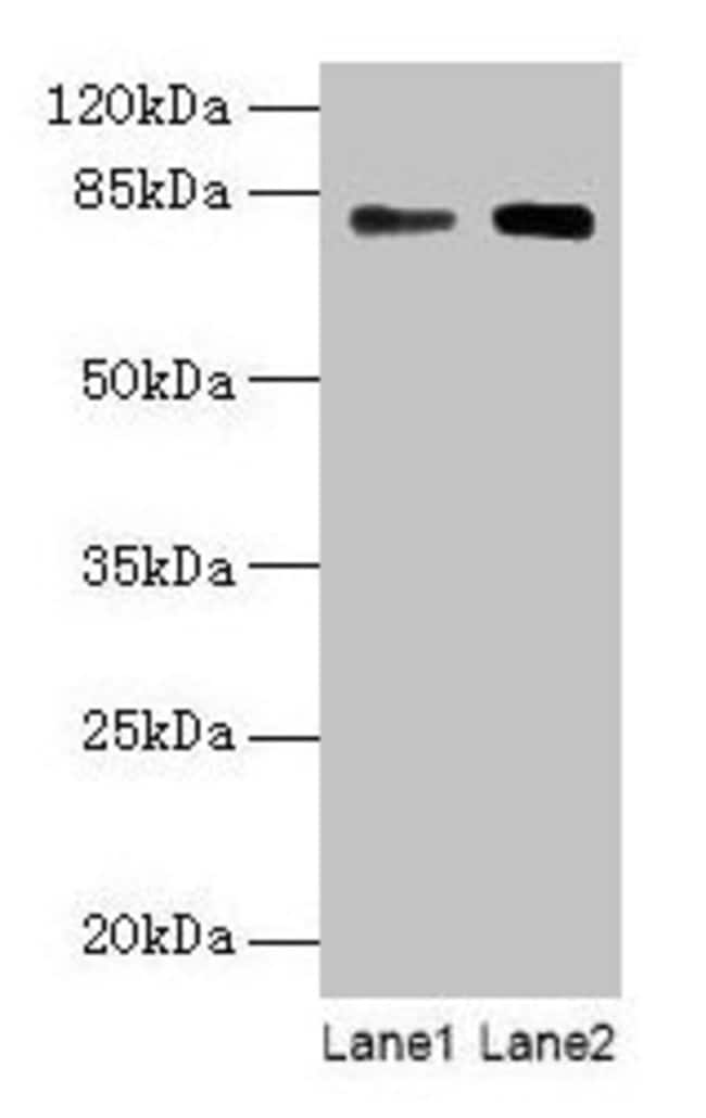100UG MASP1 ANTIBODY 100 ug