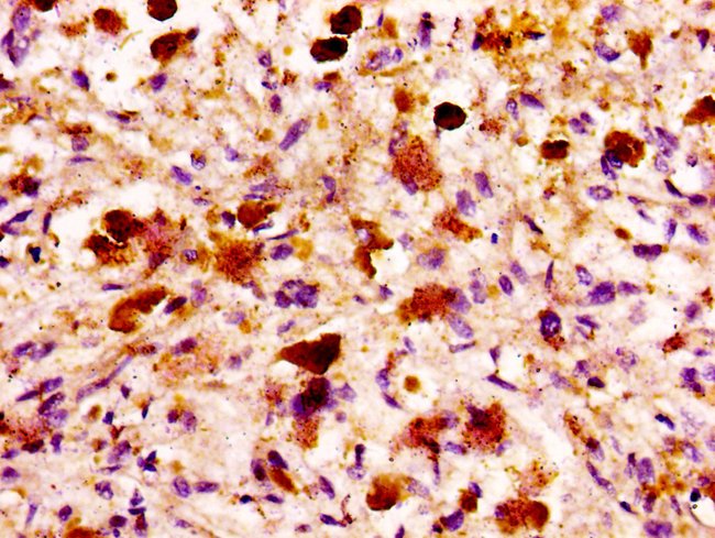 100UG MASP2 ANTIBODY 100 ug