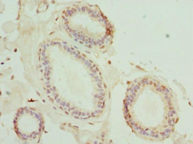 100UL MATK ANTIBODY 100 ul