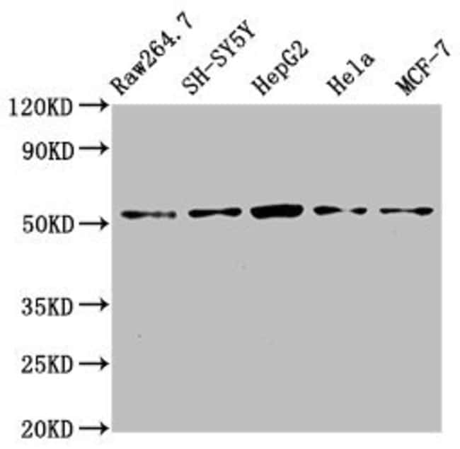 100UG MATN3 ANTIBODY 100 ug