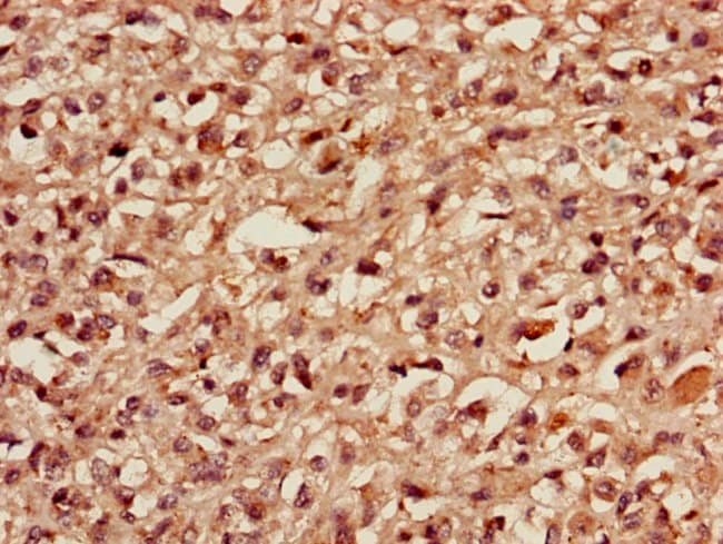 100UG MBD3 ANTIBODY 100 ug