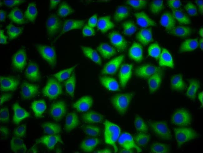 100UG MC1R ANTIBODY 100 ug