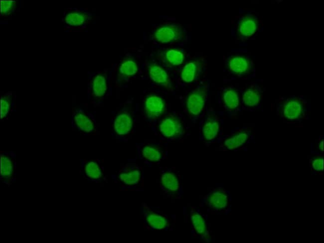 100UG MCM4 ANTIBODY 100 ug