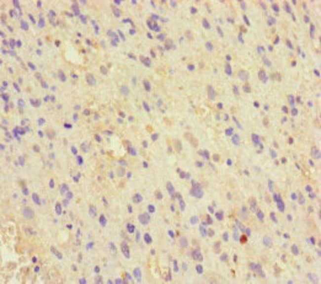 100UG MCRS1 ANTIBODY 100 ug