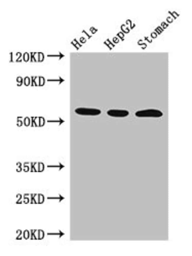 100UG MDMX ANTIBODY 100 ug