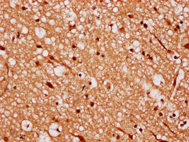 100UG RKHD4 ANTIBODY 100 ug