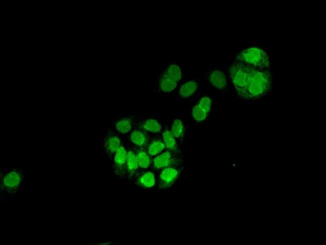 100UG MGST3 ANTIBODY 100 ug