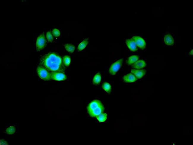 100UG PSMB2 ANTIBODY 100 ug