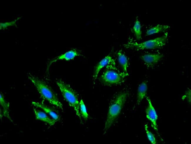 100UG MELANOPHILIN ANTIBODY 100 ug