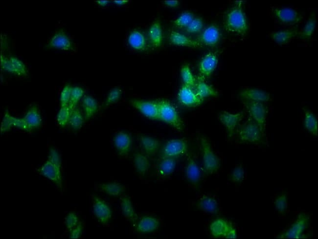 100UG MMGT1 ANTIBODY 100 ug