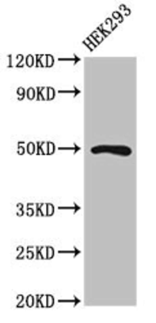 100UG HB9 ANTIBODY 100 ug