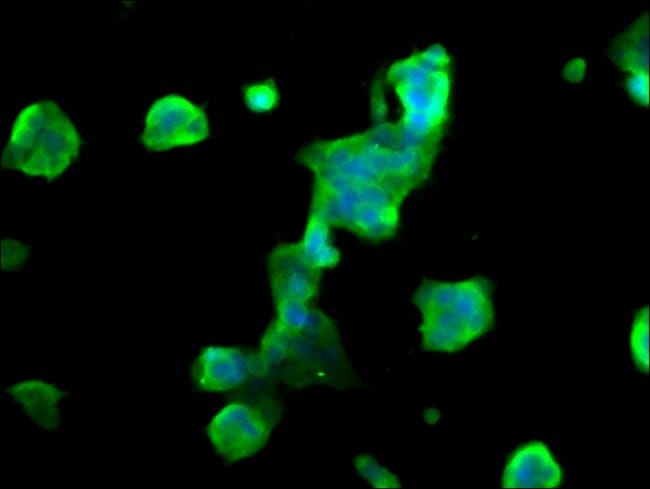 100UG MBP ANTIBODY 100 ug
