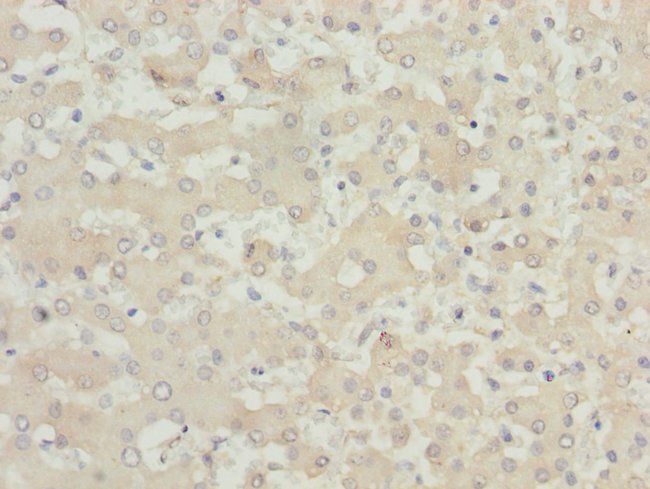 100UL MOCS3 ANTIBODY 100 ul